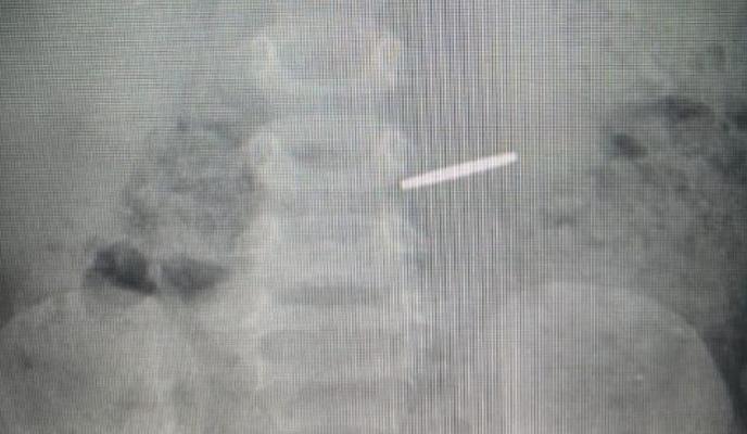 Bitrix 144140: QTIcrvOjjks.jpg