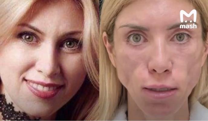 Bitrix 113396: Tarasevich-YUliya-.jpg