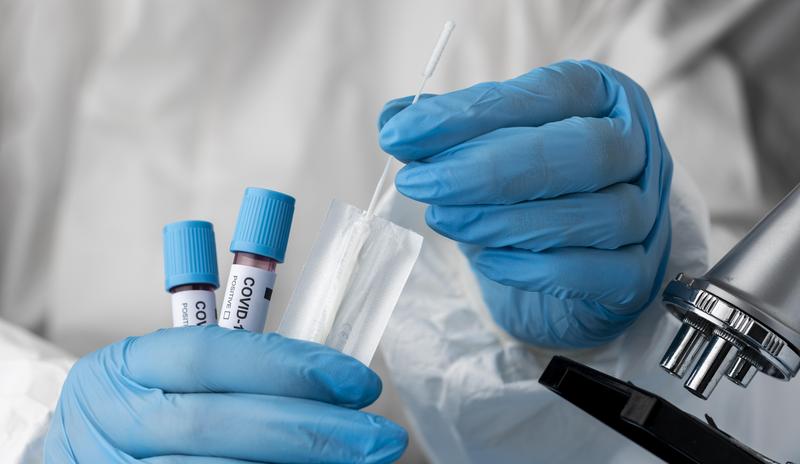 Bitrix 108403: doctor_analyzing_blood_samples_with_microscope.jpg