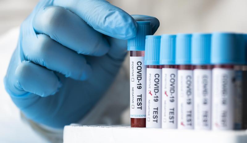 Bitrix 108453: hand_with_protective_gloves_holding_blood_samples_covid_test.jpg