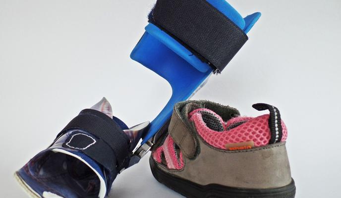 Bitrix 97478: orthosis_449685_1280.jpg