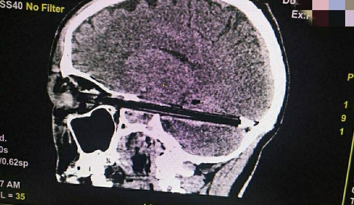 Bitrix 90408: u6gOwq6U0c0.jpg