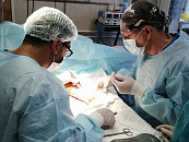 В Краснодаре хирурги спасли пациента с печеночной артерией в 10 раз больше нормы