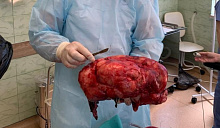 В аптеках Краснодара сохраняется дефицит физраствора вопреки указанию президента наладить поставки