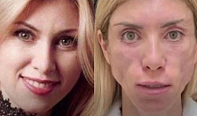 Модель из Сочи отсудила 6,5 млн рублей у краснодарской клиники