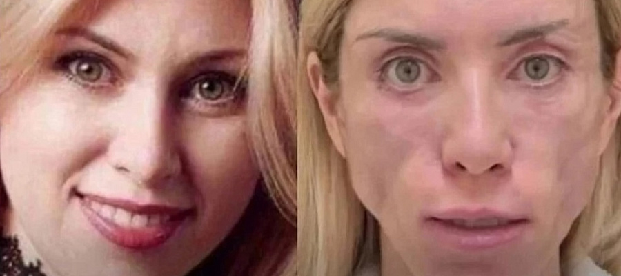 Модель из Сочи отсудила 6,5 млн рублей у краснодарской клиники