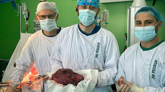 В Краснодаре врачи удалили почку с 4-килограммовой опухолью