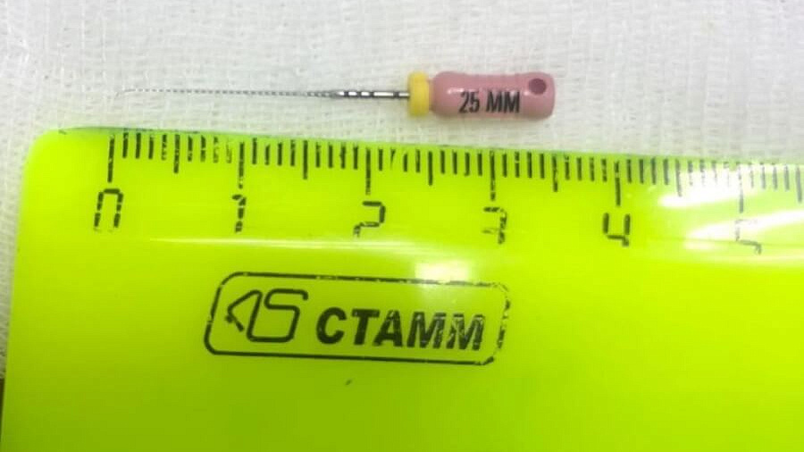 В Новороссийске женщина проглотила острый инструмент на приеме у стоматолога