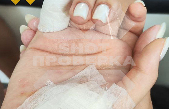 На Мальдивах акула снова покусала российскую туристку