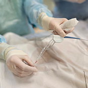 В Краснодаре врачи впервые «растворили» тромб изнутри и спасли жизнь пациентке