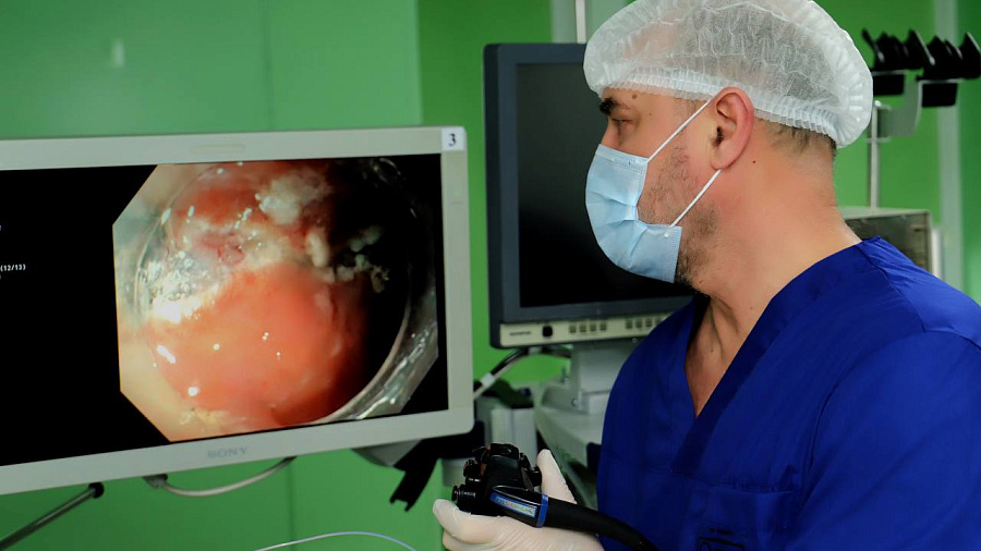 В Краснодаре врачи-эндоскописты удалили из кишечника пациента огромный полип