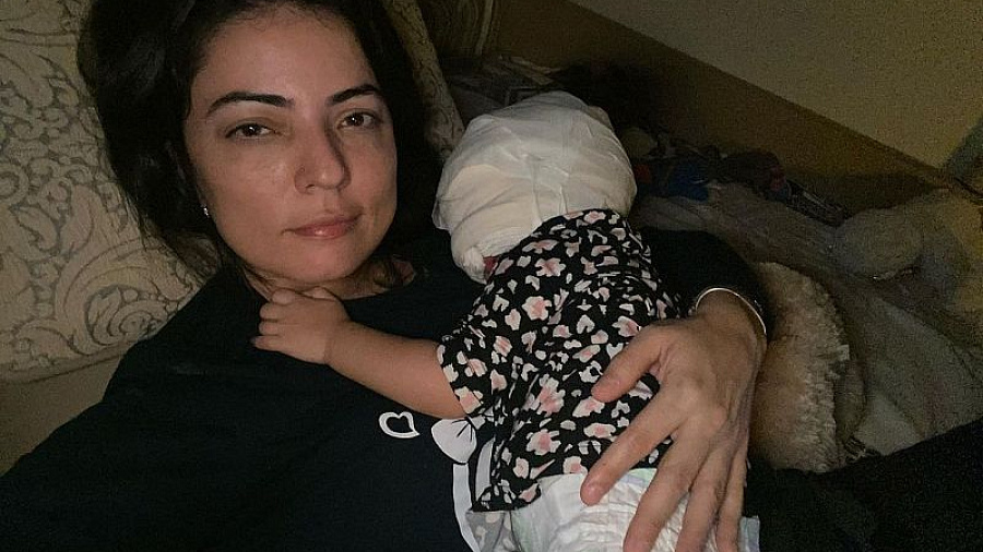 Мама девочки с «маской Бэтмена» показала фотографию дочери с огромной повязкой на лице после операции в Краснодаре