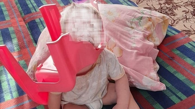 В Новороссийске спасли ребенка, застрявшего головой в горшке 