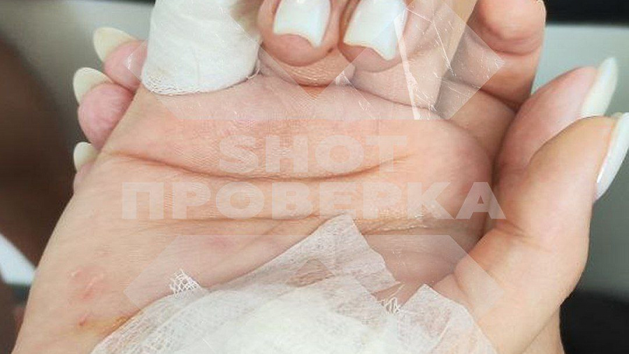 На Мальдивах акула снова покусала российскую туристку